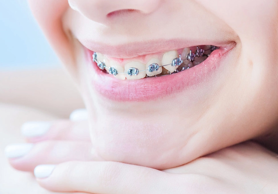 Teenager with orthodontic braces